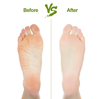 2PCS Natural Pumice Stone, Asqraqo Lava Pedicure Tools Hard Skin Callus Remover for Feet and Hands - Foot File Exfoliation to Remove Dead Skin, and Callusess - size: 2 Count (Pack of 1)