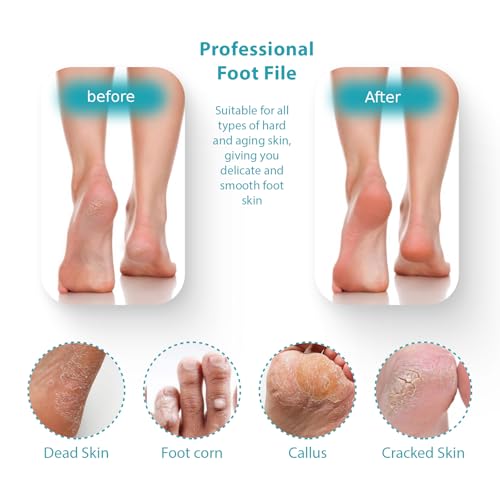 Foot File Pedicure Tool Callus Remover, Durable Foot Scrubber Dead Skin Remover, Professional Toe Cleaning Brush - color: 10.63'' Black