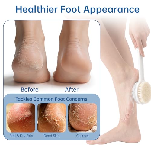 Foot Scrubber with Pumice Stone & 2 Pcs Toe Cleaning Brush, Long Handle Callus Remover for Feet, Toe Cleaning Brush for Dead Skin, Shower Foot Brush for Seniors, Elderly, Men Women (Include 4 Hooks)
