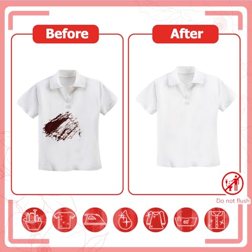Timgle 200 Pcs Instant Stain Remover Wipes, Individually Wrapped,White - color: White