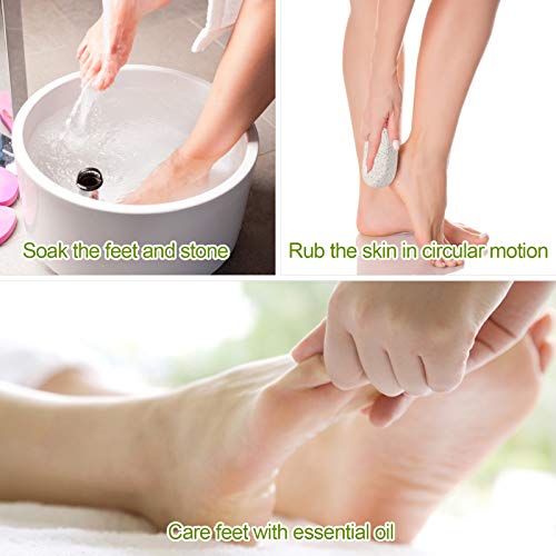 2PCS Natural Pumice Stone, Asqraqo Lava Pedicure Tools Hard Skin Callus Remover for Feet and Hands - Foot File Exfoliation to Remove Dead Skin, and Callusess - size: 2 Count (Pack of 1)