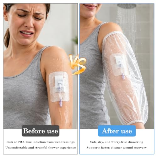 Klmnop 100 Pack Disposable PICC Line Shower Cover, Waterproof Upper Arm Sleeve for Showering, Plastic Shield Protects Bandage & Wound Fits 9-16" Arm Circumference(Clear)
