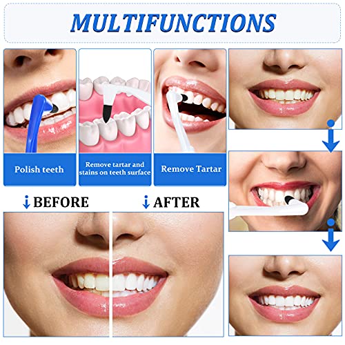 Geiserailie 8 Pcs Teeth Stain Remover Tool, Plaque Remover for Oral Care