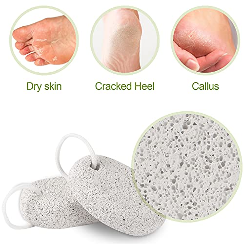 2PCS Natural Pumice Stone, Asqraqo Lava Pedicure Tools Hard Skin Callus Remover for Feet and Hands - Foot File Exfoliation to Remove Dead Skin, and Callusess - size: 2 Count (Pack of 1)