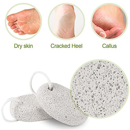 2PCS Natural Pumice Stone, Asqraqo Lava Pedicure Tools Hard Skin Callus Remover for Feet and Hands - Foot File Exfoliation to Remove Dead Skin, and Callusess - size: 2 Count (Pack of 1)