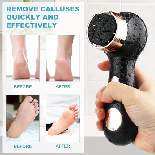 Electric Foot Callus Removers for Feet - Rechargeable Waterproof Portable Electronic Foot File Pedicure Tools for Cracked Heels Dead Skin - style: Black gold